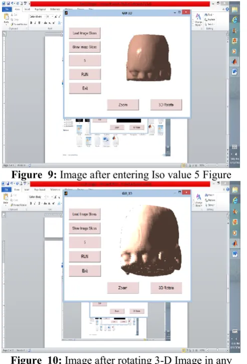 Figure  9: Image after entering Iso value 5 Figure  