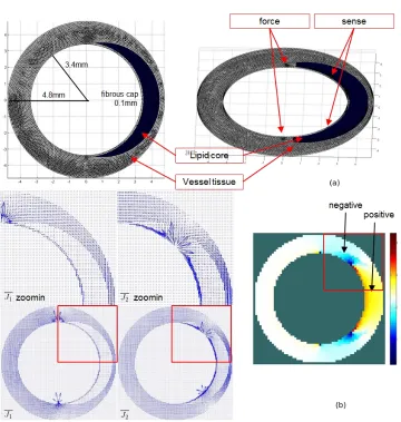 Figure 5.1.1: (a): meshed artery segment with lesion (based on human artery dimensions).