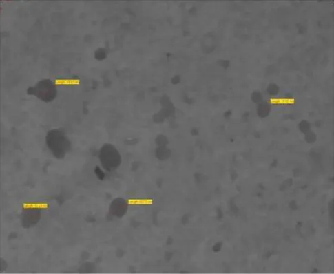 Figure-7: TEM images of optimized solid-SMEEDS of Linagliptin 