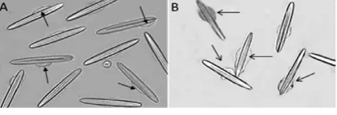 Figure 1. Morphological modifications and cell swelling in 90n/mL crude venom-treated cells (B) with respect to the control(A)