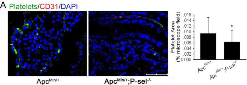 Figure 2. P-selectin mediated platelet accumulation in intestinal tumors. Immunofluorescent staining was performed with an anti-CD31 antibody to define blood vessels, a βIIb antibody for platelets and counterstaining of nuclei with DAPI