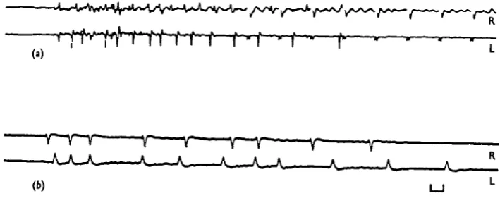 Fig. 7. (a)inserted in the extensor muscles of the jumping legs and the animal was allowed to jumpL, Response of isolated prothoracic motor neurones to wind on head: R, right side; left side