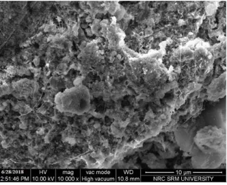 Table 1: Antibacterial activity of AgNO3 ,  AgNPS and  leaves extract of Phyllanthus niruri 