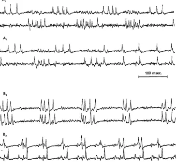 Fig. 3. Samia cynthia.longitudinal muscle) and an elevator muscle (lower traces). (A(Btwo different depressor muscles (upper traces, dorsal longitudinal muscle; lower (A) Potentials from a wing depressor muscle (upper traces, dorsalx) During flight the act