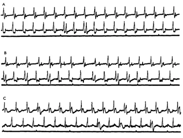Fig. 5. Mimas tiliae,(upper traces, elevator, possibly tergo-sternal muscle; lower traces, subalar muscle)