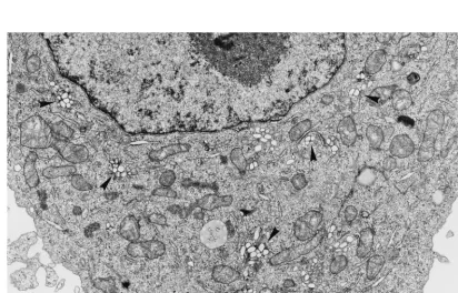FIG. 4. FISH for minus-strand detection in a series of optical sections, spaced 0.4 �single spherical granules of approximately 0.5m apart, through an infected cell at 2.75 h p.i