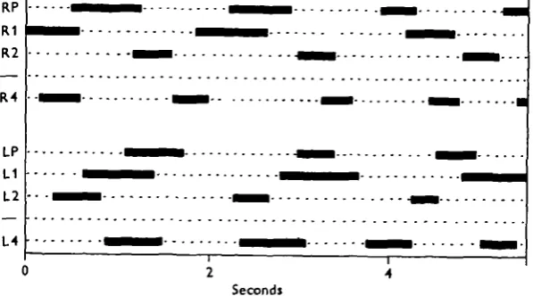 Fig. 6. Walking record from an animal with the third legs tied up. The bind legs step at higherfrequency and are not well correlated in phase with the others.