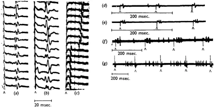 Fig. 12. Records from the transverse nerves of spiracles i and 2 during the stimulation of abundle of the split connective between GI and Gil with single shocks (A ) in preparations