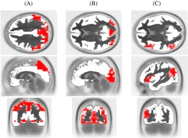 Figure 3: The formed regions of interest of brain areas assumed to be responsible for estimation (A), mental imagery (B) and computation (C)
