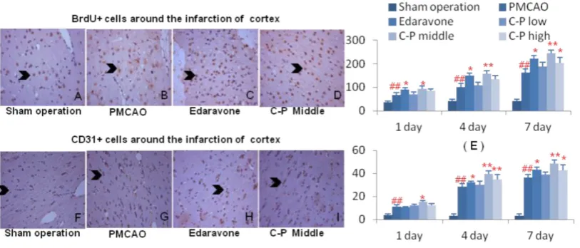Figure 7.  Aniogenesis around infarct of cortex. Immunohistochemical stains of BrdU and CD31 were performed on the 1th, 4th, 7th day around infarct of cortex
