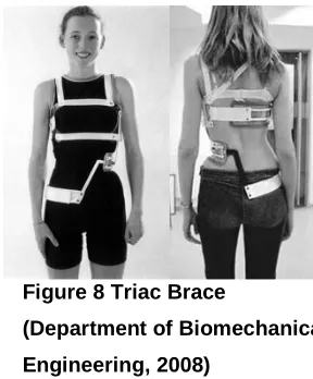 Figure 8 Triac Brace 