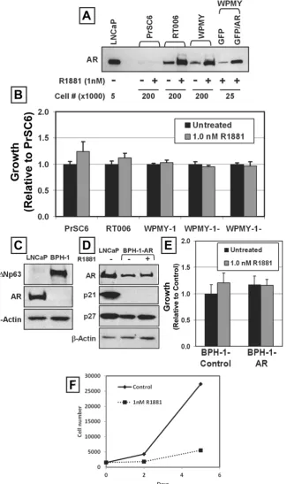 Figure 5: AR-Mediated Growth Inhibition is Cell-Context Dependent. (A) AR-mediated growth inhibition in the absence of p53 HPr-1AR