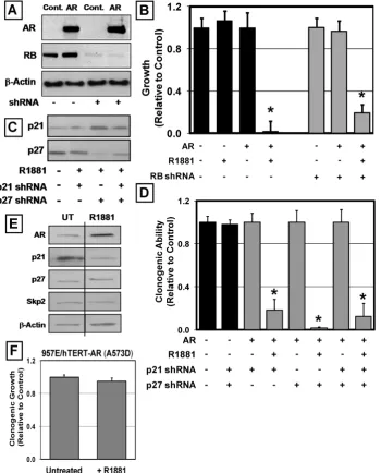 Figure 6: AR-Mediated Growth Inhibition does not Require RB, p21 or p27 but does Require DNA Binding