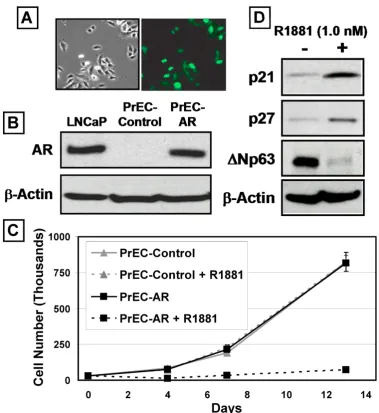 Figure 1: AR Inhibits the Proliferation of Human Prostate Epithelial Cells (PrECs).  PrEC-Lenti-GFP/AR cells before R1881 treatment, right panel, phase contrast and left panel fluorescence microscopy showed ~80% GFP expression