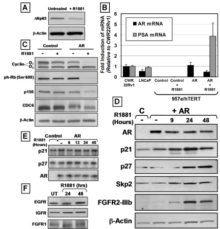 Figure 3: AR Expression Induces Luminal Differentiation and SKP-2-Independent Increases in p21 and p27 Protein Expression