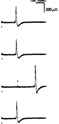 Fig. 5. Triggered NP's. Judging from the long latency, the NP in the third sweep is spon-taneous and not triggered