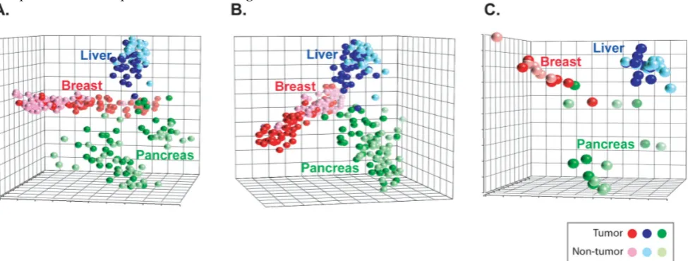 Figure 1. Metabolites patterns can distinguish cancers. nontumor (lighter shades) of liver, pancreas and breast tissues among 563 measurable metabolites or (a) A principal component analysis plot is shown comparing the metabolite status of tumor (darker sh