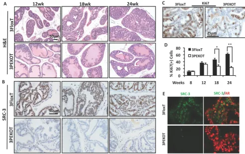 Figure 4. Slower progression of AH tumors in 3PEKOT mice. mice. calculated by dividing the number of ki67+ tumor cells by total number of tumor cells per imaging field