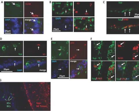 Figure 6. NE tumors may be derived from intermediate progenitor cells expressing SV40-T antigen