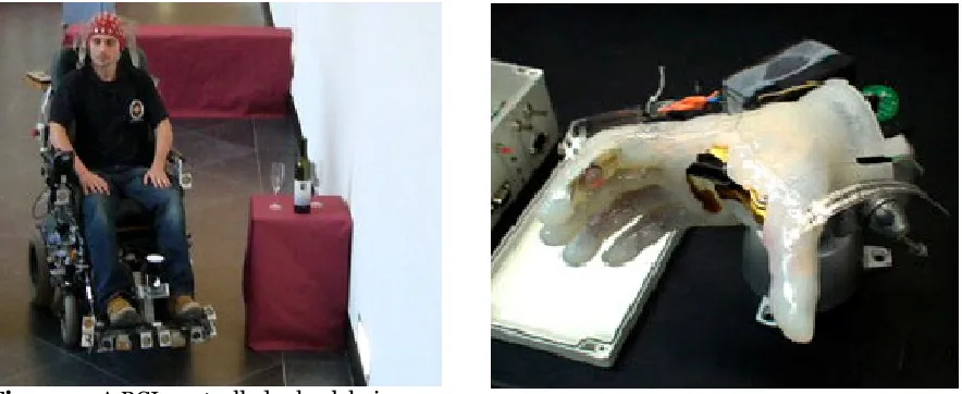 Figure 4. A BCI-controlled-hand-prosthesis. 