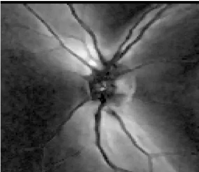 Figure 3.4  Grayscale representation of the RNFL thickness map image 