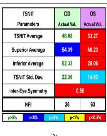 Figure 3.5(b)  a) GDx VCC Printout  b) Parameters with their probability of normality (colorcoded) (Courtesy: Laser Diagnostics, San Diego, CA)  