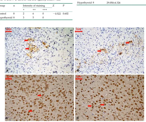 Table 4. Variations in ARPC5 expression at P1 in the cortical layer III and IV of control rats and hypothyroidism rats