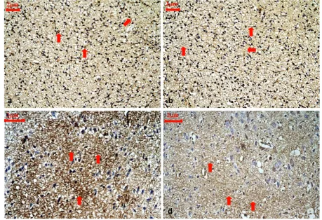 Fig. 4. Representative immunohistochemical staining for ARPC5 protein expression in the cortical layer III and IV of control rats and hypothyroidism rats during development, 400×