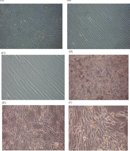 Fig 5. Morphological changes in skin fibroblasts at passage 6 after 1.25% CSE exposure for 24 h