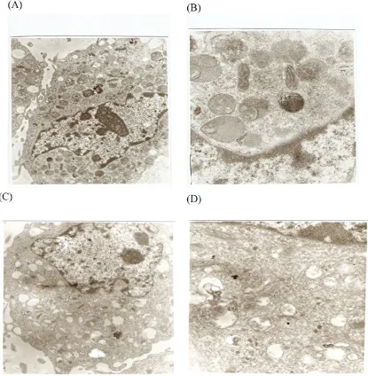 Fig 7. Effects of CSE on ROS production in mitochondria. CSE dose-dependent increase in ROS-mediated conversion of DCFH to fluorescent DCF in H2DCF-DA–loaded isolated mitochondria incubated with the indicated concentrations of CSE