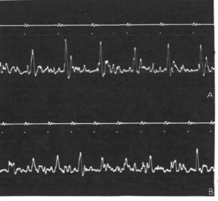 Fig. 2 shows a series of oscillograms of action potentials in the tympanic nerveThe nervous response to sounds consisting of trains of pulses was also studied.square wave generator; at pulse repetition frequencies betweenof a male Stenobotkrus lineatus due to stimulation with pulsed sound from the 1 and 90 per second