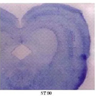Fig. 1: Isolated whole Brain picture of normal and ST 80 formulation administered rat.Normal brain do not show any blue staining by the dye but ST 80 (EST 80)formulation administered   brain shows extravasation of the dye in to thebrain bypassing blood brain barrier)