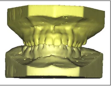 Fig. 9 : Digital Models  reconstructed using MIMICS software