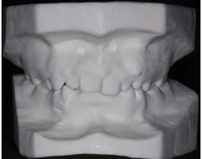 Fig. 13 : Composite Prototype models  