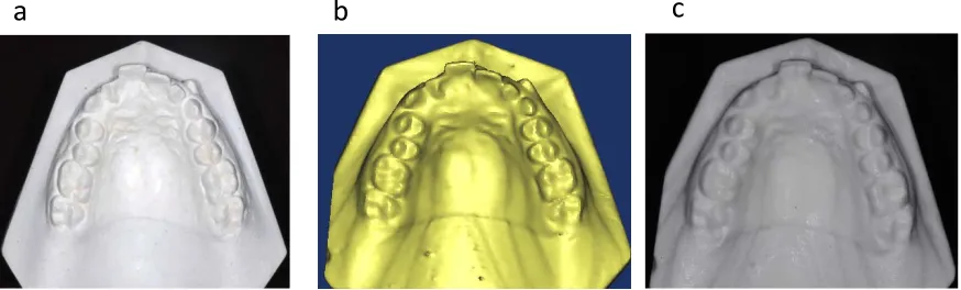 Fig. 14 : Comparison of Plaster, Digital and Reconstructed upper study model