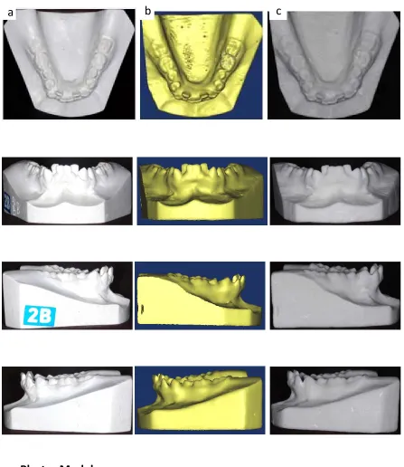 Fig. 15 : Comparison of Plaster, Digital and Reconstructed lower study model