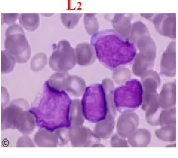 Figure 3: ALL-L3 [11] 