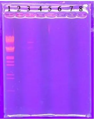 Fig.No.  7.2 DNA from Buccal cells.