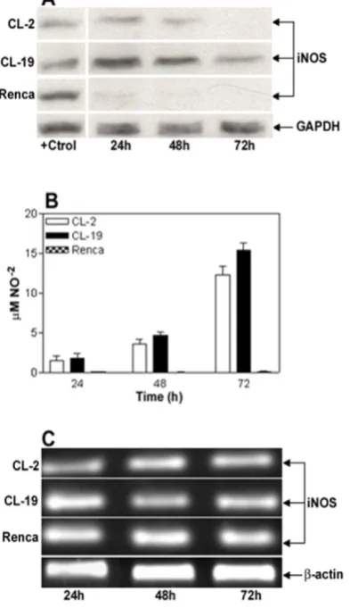 Figure 1. Characterization of iNOS expression and iNOS activity in murine RCC cell lines cultured in normal condi-was loaded per line