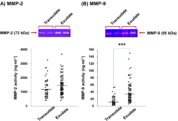Figure 3. MMP-2 and MMP-9 activities in pleural transudative and exudative effusions. The activities of MMP-2 (A) and MMP-9 (B) in pleural transudative and exudative effusions from 125 patients were determined with zymography