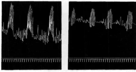 Fig. 7. Two records of the same isolated extrovert preparation. On the left, in sea water.On the right, 30 min