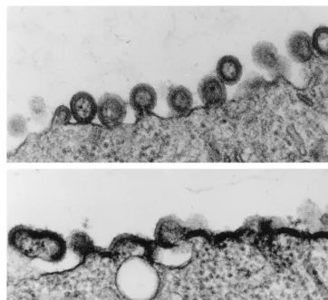 FIG. 1. Thin sections of Sfwild type, Tyr79Ala produced deformed, only partly budded particles and an accumulation of Gag antigen at the membrane typical of other virus assembly mutants9 cells expressing wild-type Pr55 (top panel) or Pr55 bearing the Tyr79