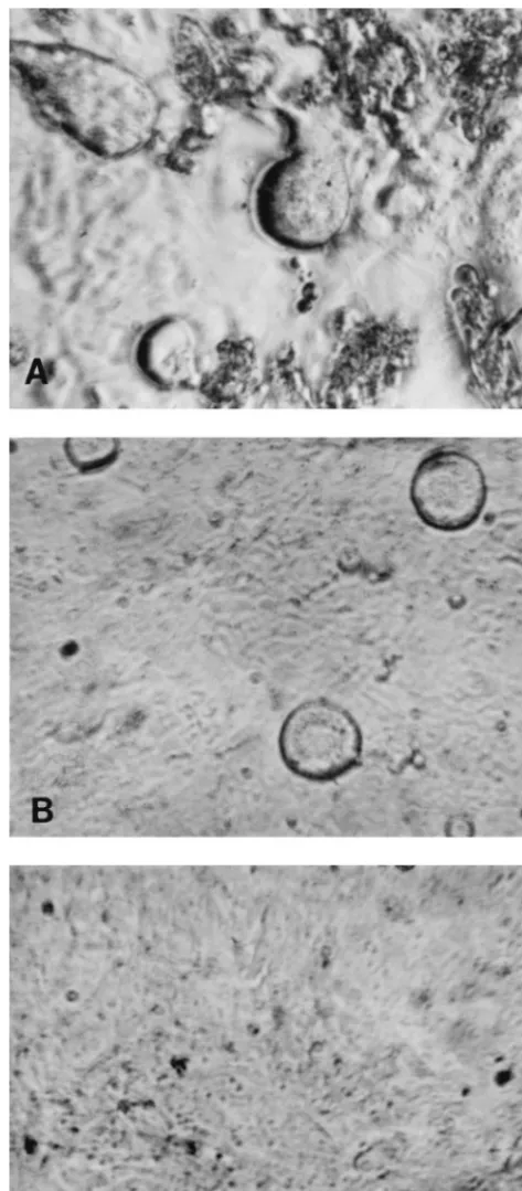 FIG. 3. (A) Kinetics of infection of SF33 in GHOST-X4 (IC) Effect of pretreatment with HIV immune serum pool 2 (((I�) and GHOST-R5) cells and of 92HT593 in GHOST-X4 (F) and GHOST-R5 (E) cells