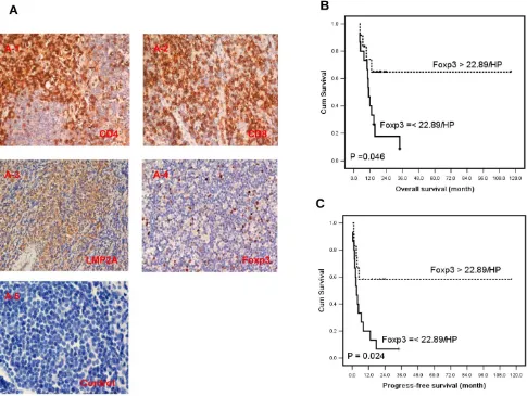 Figure 4. The expression of CD4, CD8 and Foxp3 in TILs and LMP2 in tumor cells of ENKTL patients and results of survival rate with Foxp3+ TILs in ENKTL patients