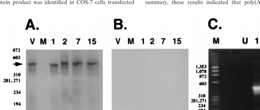 FIG. 2. Detection of splicing in poly(A)�The cDNA reaction containing RT was subsequently ampliﬁed by using theLRT-speciﬁc primers in the nested PCR (A)