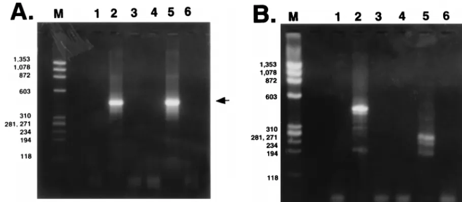 FIG. 4. Analysis of LRT expressed in transfected COS-7 or infected MDBK cells. (A) PCR ampliﬁcation of poly(A)�poly(A)and without (lane 6) RT, using poly(A)M,of poly(A) LRT from transfected or infected cells