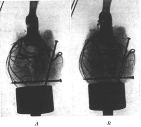 Table II. The cross-sections of the aorta and coronary arteries in cats' hearts 24