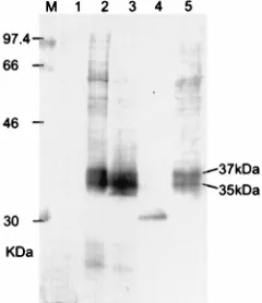 FIG. 1. Reactivity of an AIDS KS patient serum with a glycosylated BCBL-1cell protein