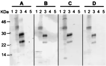 FIG. 2. Reactivities of four AIDS-KS patient sera (A to D) with BCBL-1 cellproteins and recombinant HHV-8 proteins