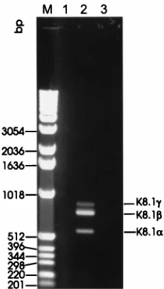 FIG. 4. RT-PCR of reading frame K8.1. using DNase I-digested RNA ex-tracted from TPA-induced BCBL-1 cells